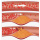 cholesterol